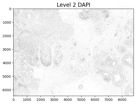 shlee-20230111-kb-xenium-scale-factors-07.png