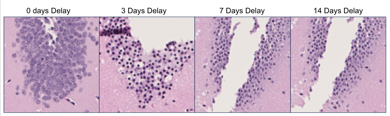 How does delayed fixation impact Xenium performance?